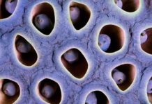 Why Are People With Trypophobia Horrified By Holes?